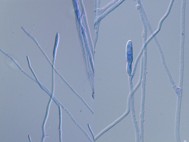 Ophiocordyceps pseudocommunis